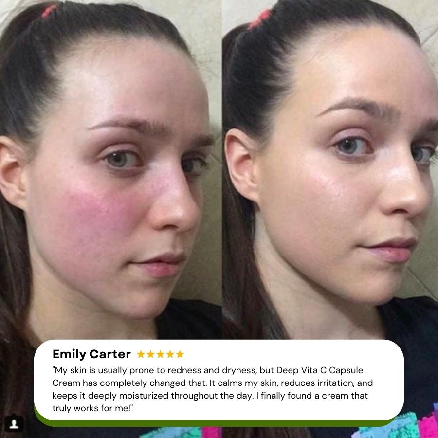 🔥Glow Capsule Cream💥20% OFF Deal